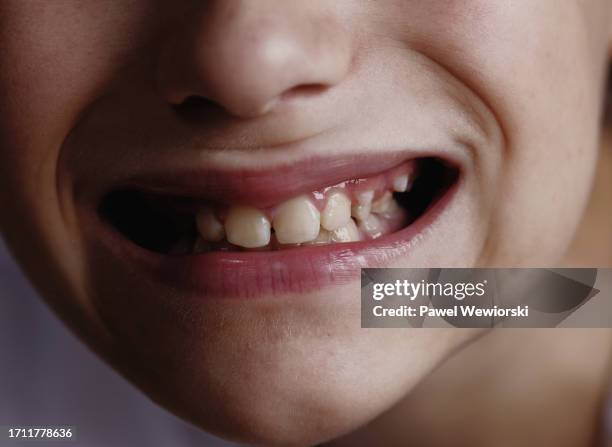 boy smiling and showing permanent teeth coming out - open day 13 stock pictures, royalty-free photos & images