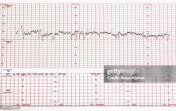 diagramma clinica - chart foto e immagini stock