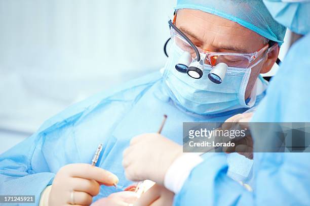 dental operation - implant 個照片及圖片檔