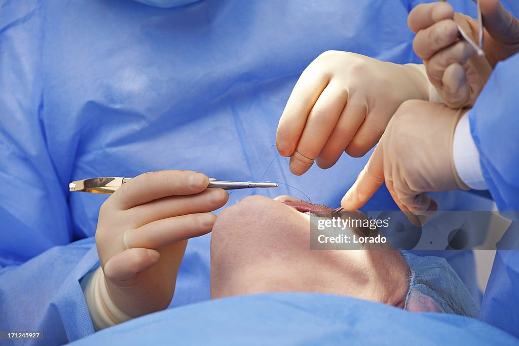 Dental operation