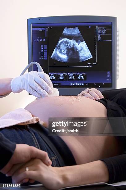 ultrasound profile - scientific imaging technique stock pictures, royalty-free photos & images