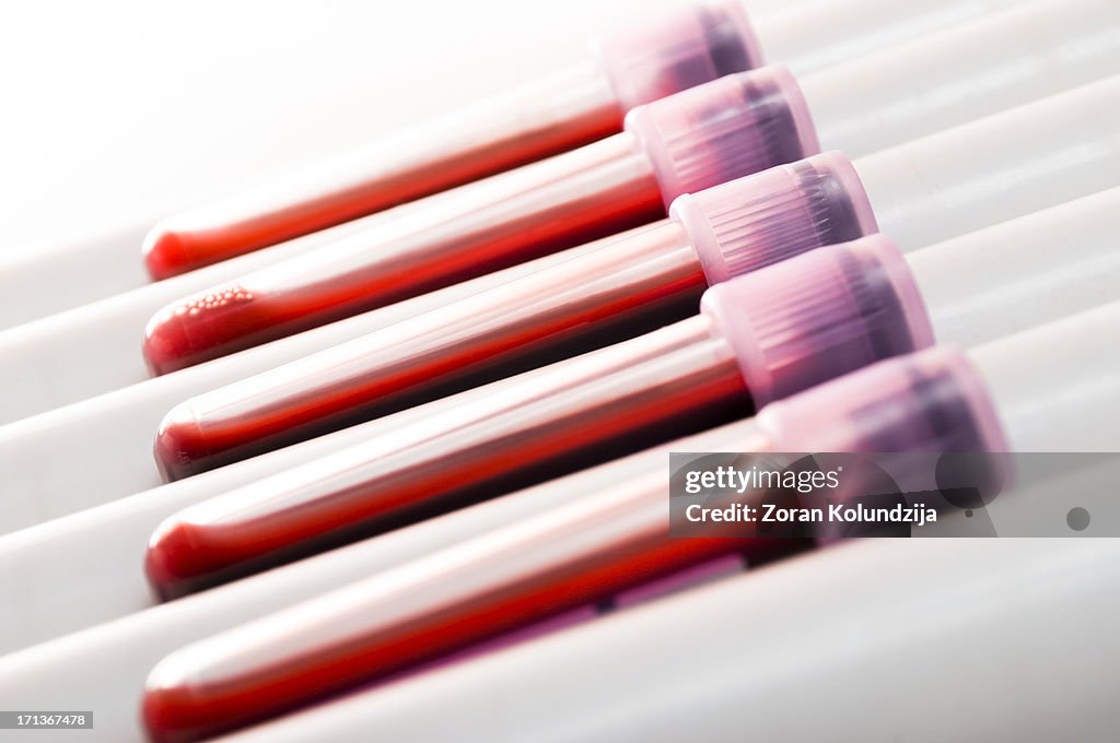 Blood samples (shallow DOF)