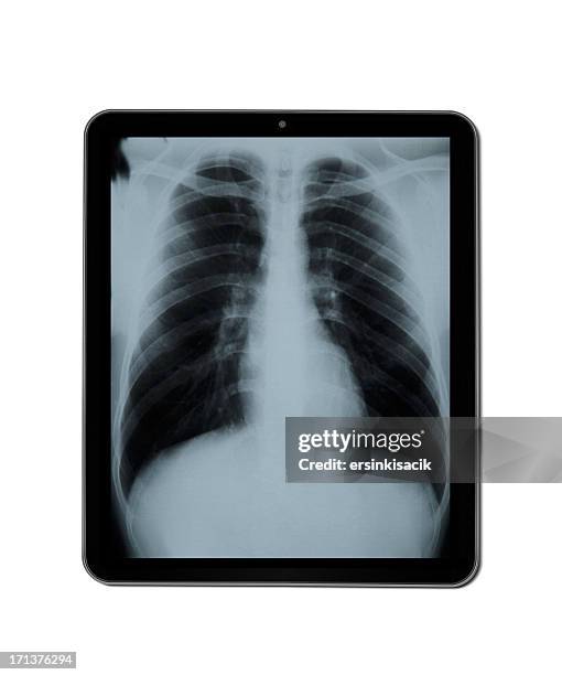 Chest X Ray Computer Chest Xray Modern Photos and Premium High Res Pictures - Getty Images