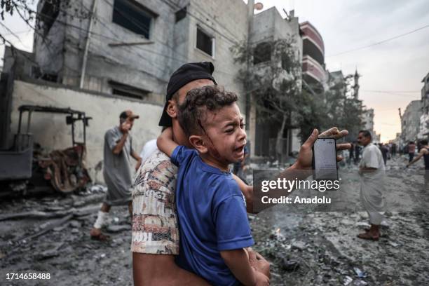 An injured Palestinian kid is seen after Israeli airstrikes at al-Shati refugee camp in Gaza Strip on October 09, 2023.