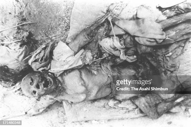 Body of the victim of Nagasaki atomic bomb is seen in August 1945 in Nagasaki, Japan. The world's first atomic bomb was dropped on Hiroshima on...