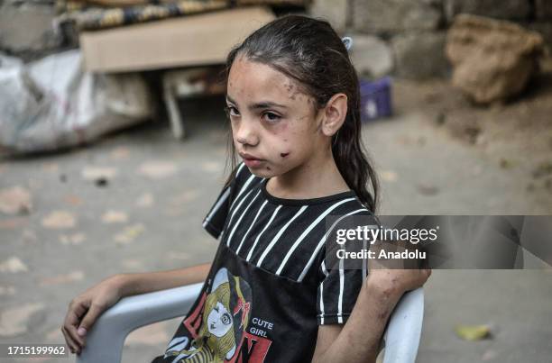 Palestinian girl Tala Huseyin Abu Dakka , who lost her whole family in Israeli attacks in Gaza, mourns near her grandmother in Khan Yunis, Gaza on...