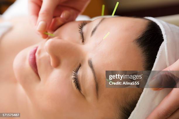 middle aged woman getting acupuncture treatment at the spa - acupuncture needle stock pictures, royalty-free photos & images