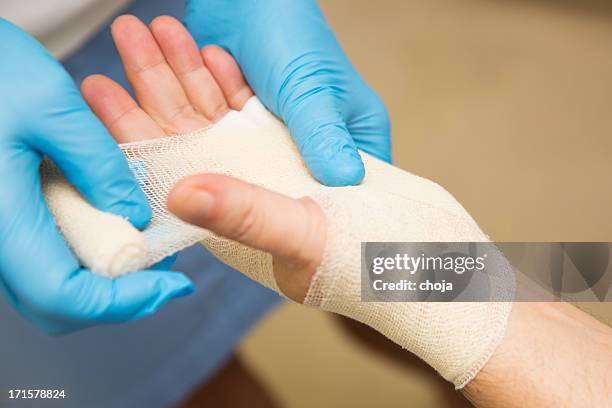 nurse is treating patient after carpal tunnel syndrome operation - bandage stockfoto's en -beelden