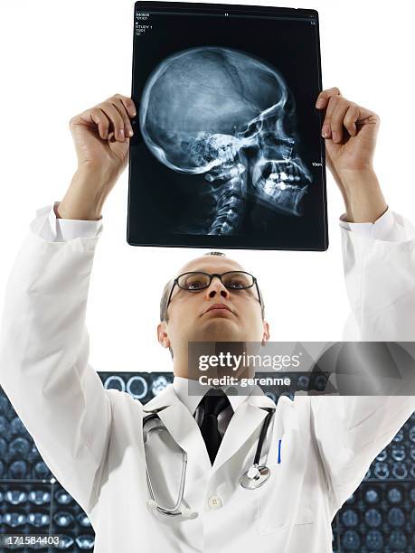 doctor looking at x-ray - doctor arms raised stock pictures, royalty-free photos & images