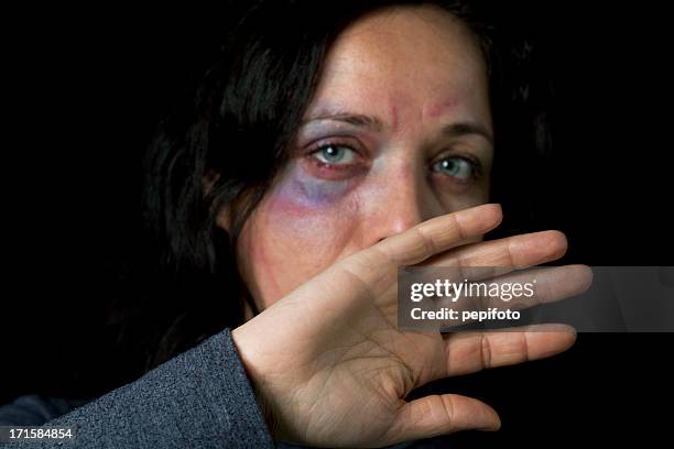 häusliche gewalt opfer - prellung stock-fotos und bilder
