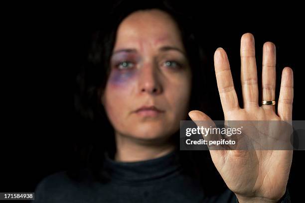 häusliche gewalt opfer - woman violence stock-fotos und bilder