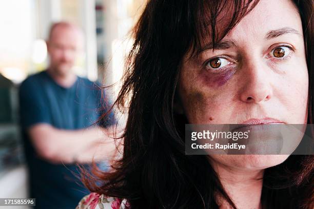 battered mulher gazes infelizmente, a câmara; bully monstros esconde-se atrás da sua - machucado imagens e fotografias de stock