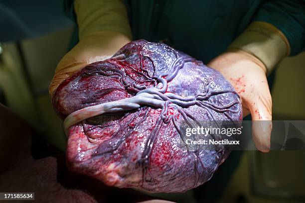 doctor showing placenta just after childbirth - female reproductive organ stock pictures, royalty-free photos & images