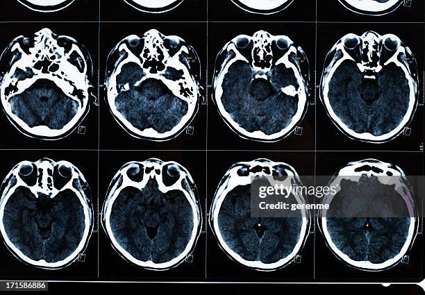 human ct scan - ct scan stock pictures, royalty-free photos & images