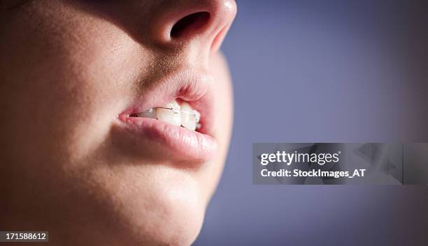 young adult woman with dental brace - fat lips stock pictures, royalty-free photos & images