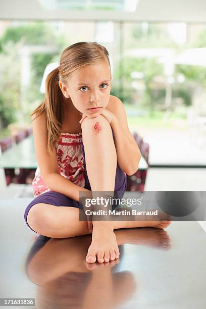 girl with scraped knee - scraped knee stock pictures, royalty-free photos & images