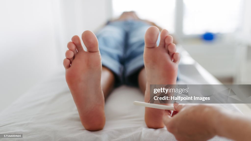 Diabetologist testing for loss of sensation in a patient's feet.