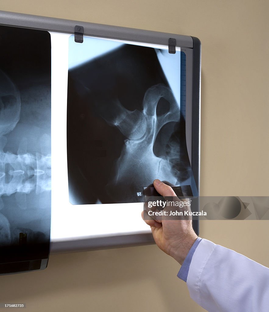 X-rays on light table