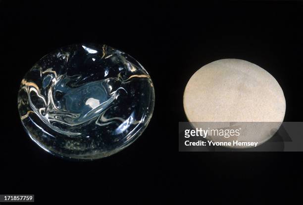 Silicone gel and polyurethane breast implants, January 11, 1991 in New York City.