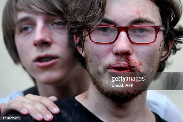 Gay rights activist is seen after clashes with anti-gay demonstrators during a gay pride event in St. Petersburg on June 29, 2013. Russian police...