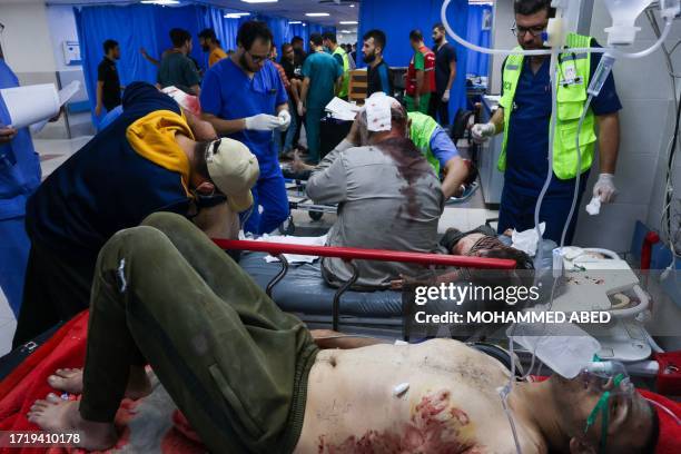 Graphic content / Medics attend Palestinians, wounded by Israeli airstrikes, at Al-Shifa hospital in Gaza City on October 11, 2023. Israel on October...