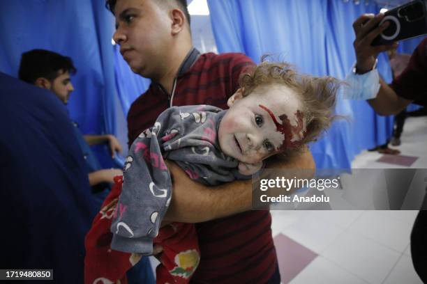 Man carries an injured baby after they were brought to Al-Shifa Hospital, in Gaza City, Gaza as Israel's attacks on the Gaza Strip continue on its...