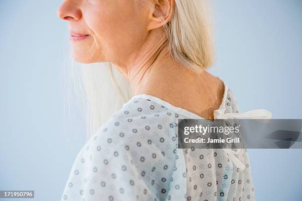 senior woman in hospital gown - hospital gown imagens e fotografias de stock