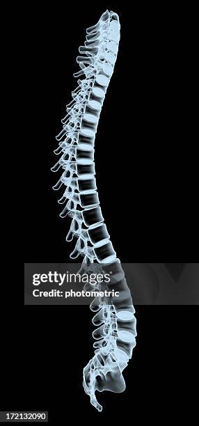 spinal xray - ruggengraat stockfoto's en -beelden