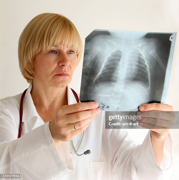 doctor observing an x-ray of the chest - child having medical bones stock pictures, royalty-free photos & images