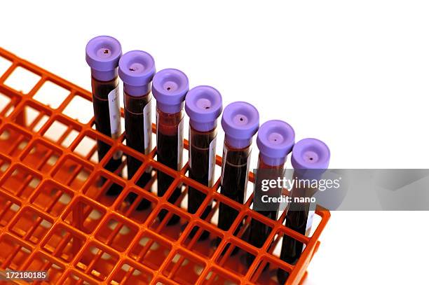 blood tubes in rack - blood tubes stockfoto's en -beelden