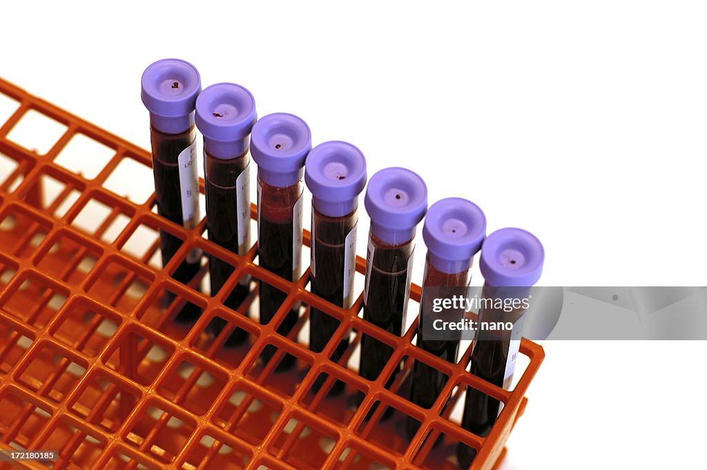 Blood tubes in rack