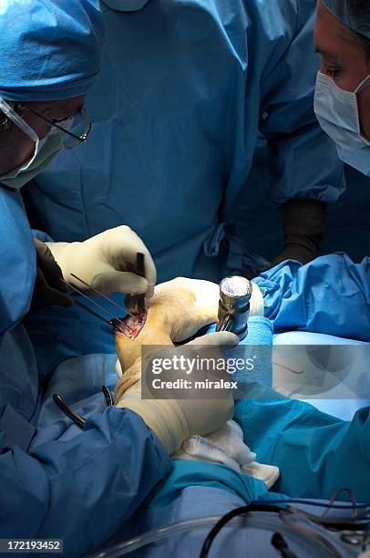 surgeon using mallet hammer during hand surgery - mallet hand tool stock pictures, royalty-free photos & images