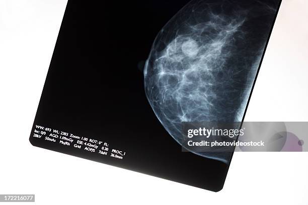 mammogram - mammogram stock pictures, royalty-free photos & images