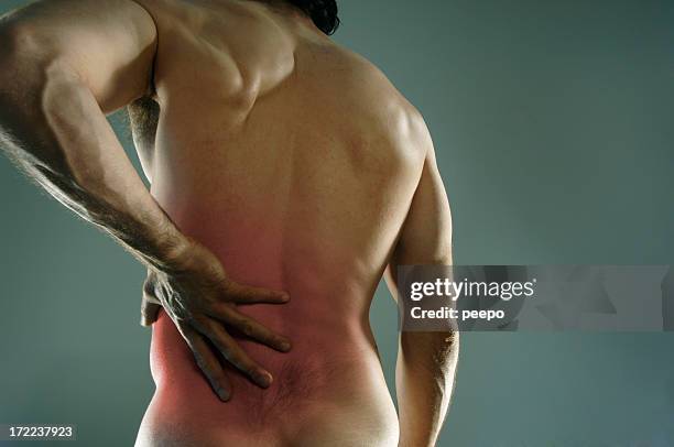 back pain - bruise stock pictures, royalty-free photos & images