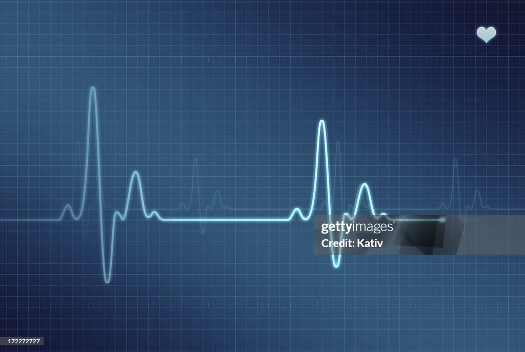 El ECG: electrocardiograma (XXL