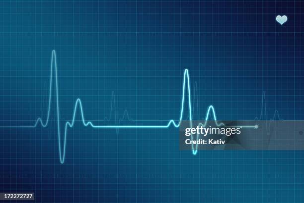 ecg: elettrocardiogramma (xxl - heartbeat foto e immagini stock