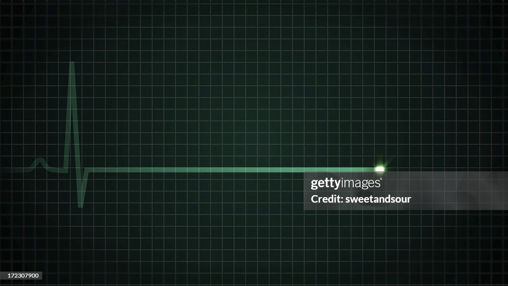 Herz-EKG Flatline