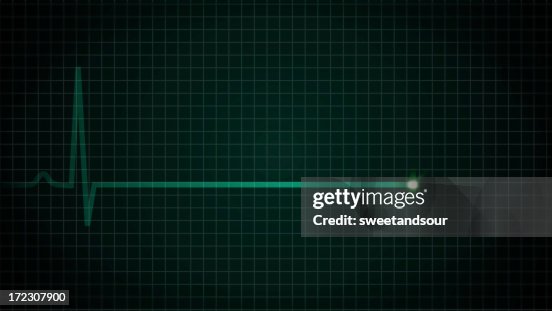 Coração Flatline EKG Coração Flatline EKG