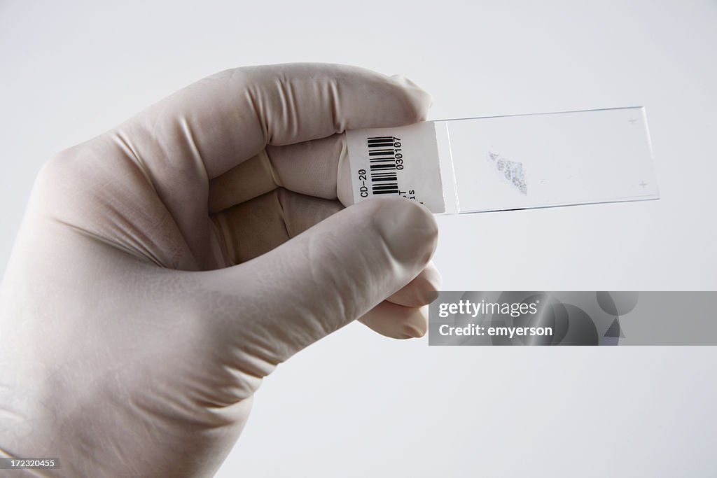 Pathology Slide