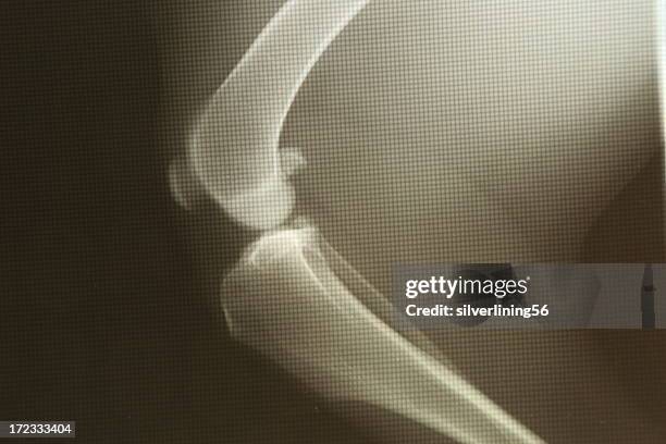 canine knee radiograph - dog family stock pictures, royalty-free photos & images