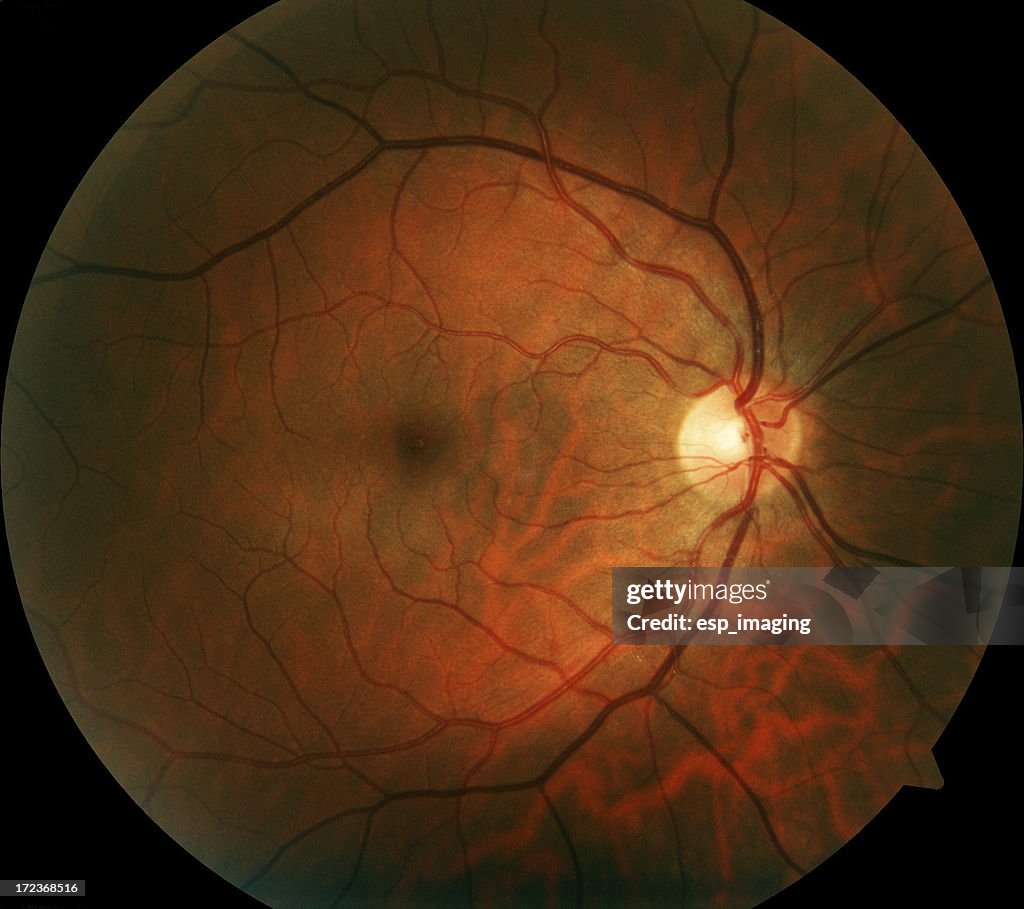 Human Retina