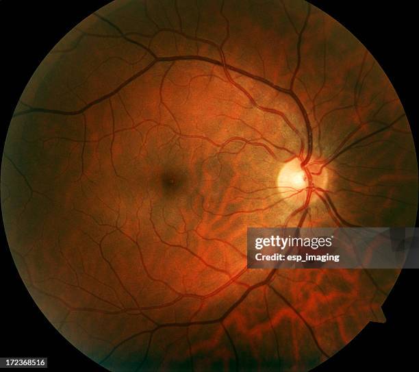 retina humano - disco óptico imagens e fotografias de stock