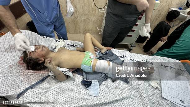 An injured child is brought to hospital after Israeli attacks as Israel's attacks on the Gaza Strip continue on the eighth day in Deir-Al-Balah, Gaza...