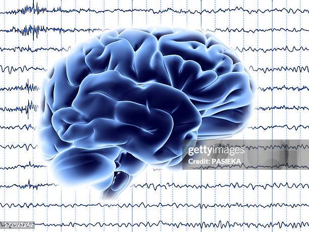 illustrations, cliparts, dessins animés et icônes de brain activity, artwork - électroencéphalogramme