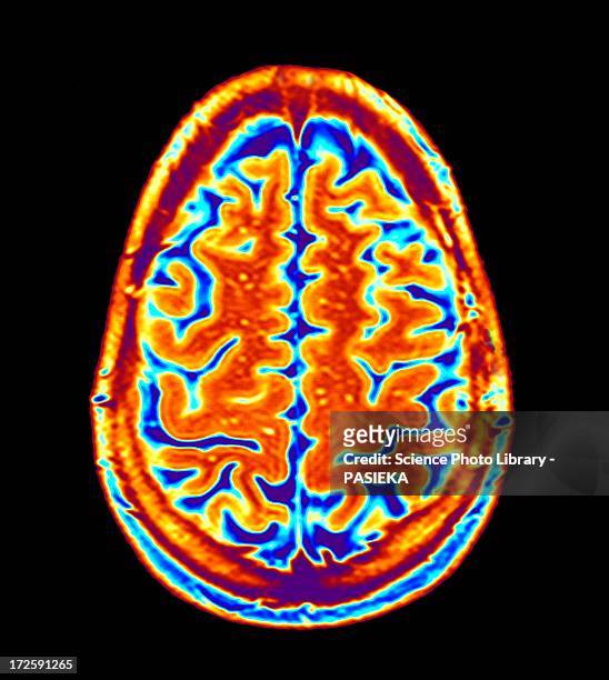 brain scan, mri scan - medical scanner fotografías e imágenes de stock
