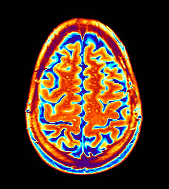 Red Brain Scan 8,865 Color Brain Scan Stock Photos, High-Res Pictures, and Images ...