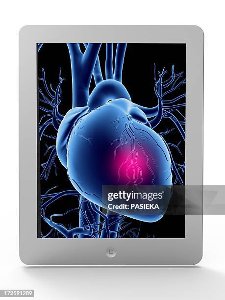 tablet computer, heart attack artwork - ipad vertical white background stock illustrations