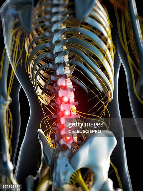 Back Problems Skeleton 131 Low Back Pain Skeleton Stock Photos, High-Res Pictures, and Images ...