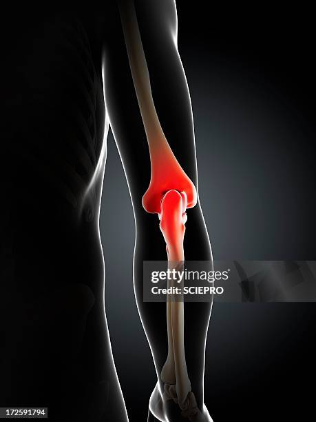 elbow pain, conceptual artwork - elbow stock illustrations