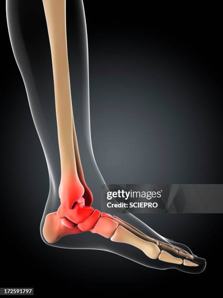ankle pain, conceptual artwork - ankle stock illustrations